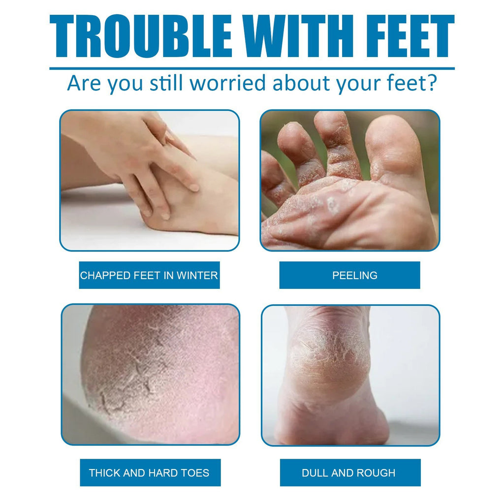 West & Montreal Exfoliating Foot Mask